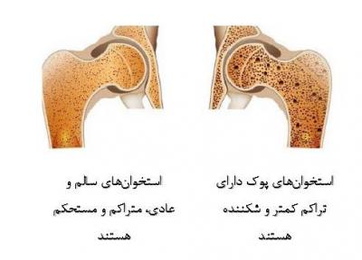 درمان پوکی استخوان با توکوترینول های موجود در روغن پالم